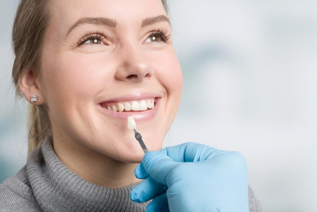 applying veneers to girl teeth