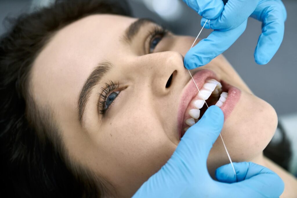 dental cleaning process