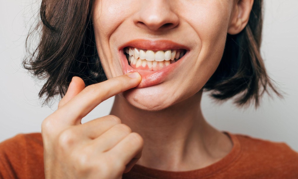 How to Prevent Gum Recession Tips and Techniques for a Healthy Smile