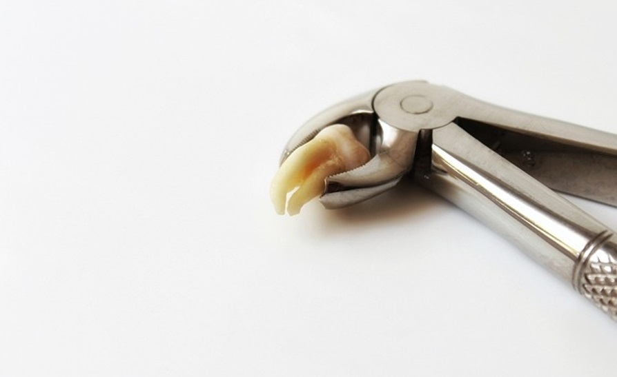 What to Eat After Tooth Extraction PostTooth Extraction Diet — You Make Me Smile Dental Centre