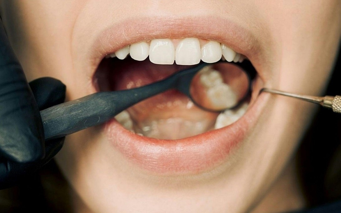 Close-up of a dentist checking a patient's teeth