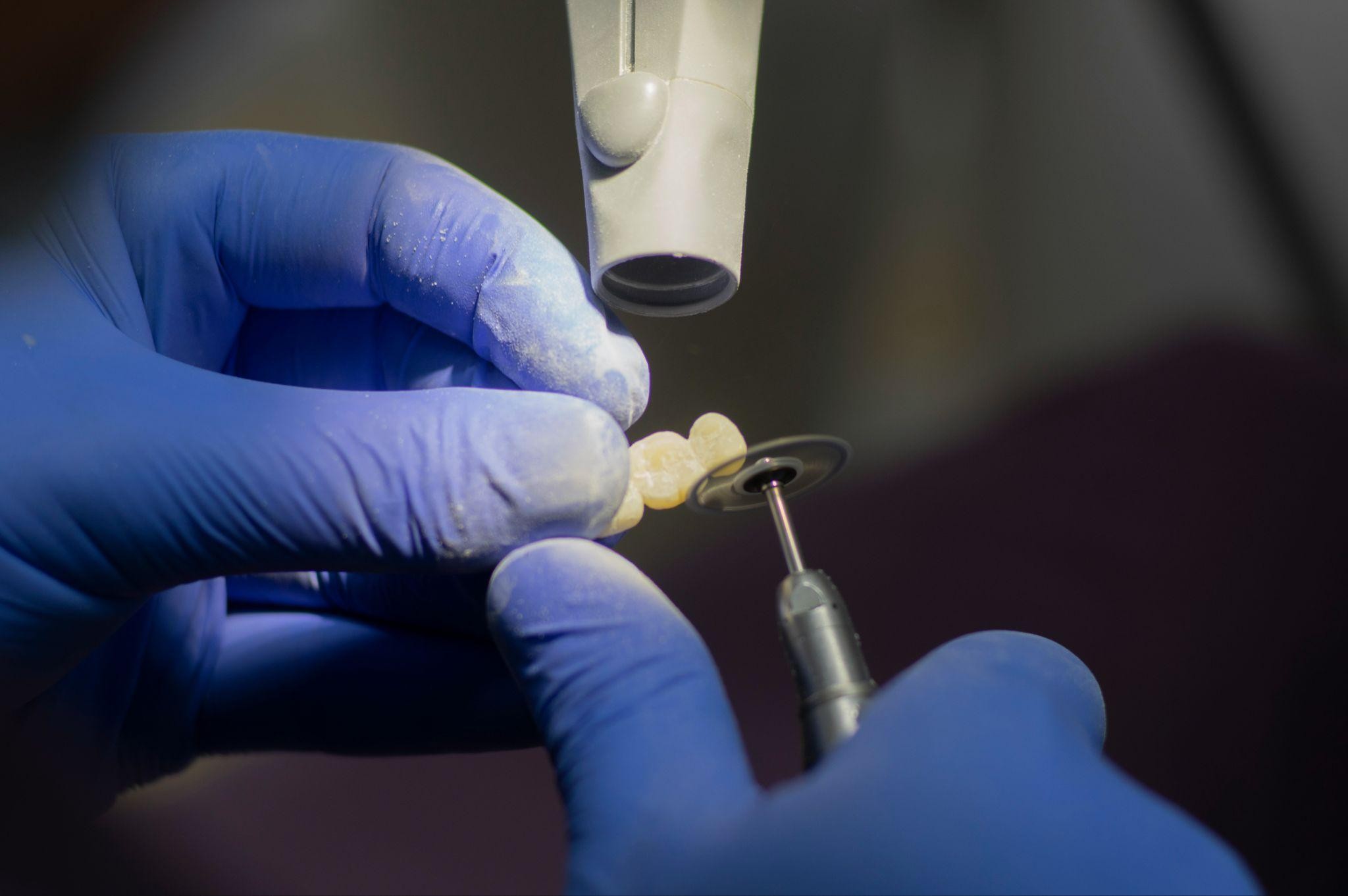 Close-up of a dentist's hands, using tools to refine a dental crown
