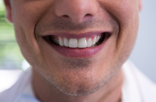gummy-smile-treatment-near-me