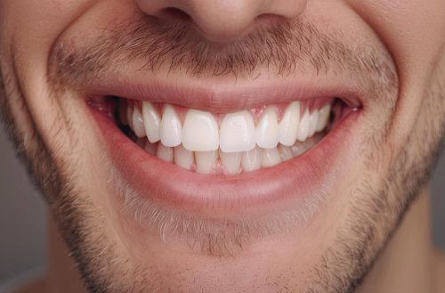 laser-gum-contouring