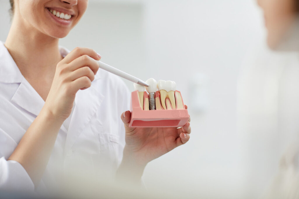 same-day-dental-implants